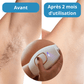 Épilateur laser Liskin IPL™