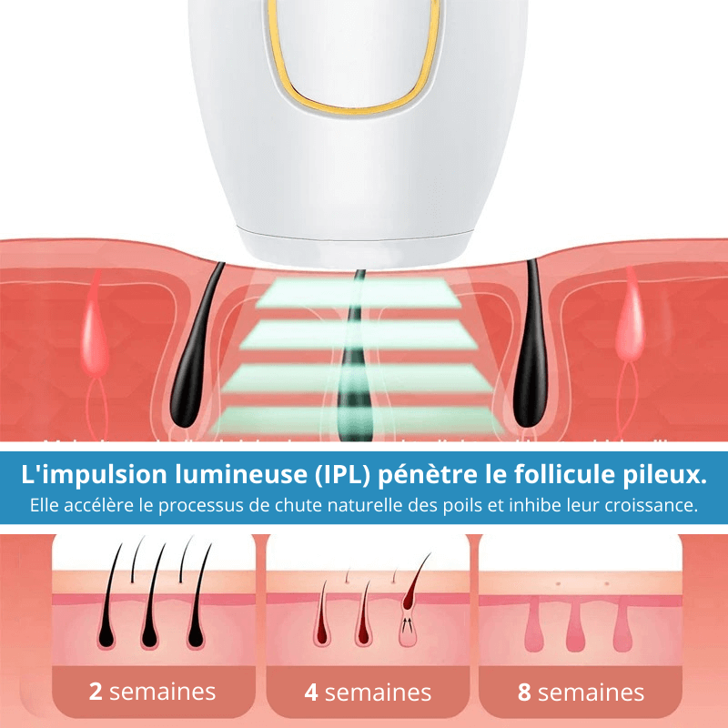 Épilateur laser Liskin IPL™